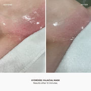 Yoni gel masker ( vajaycial mask)